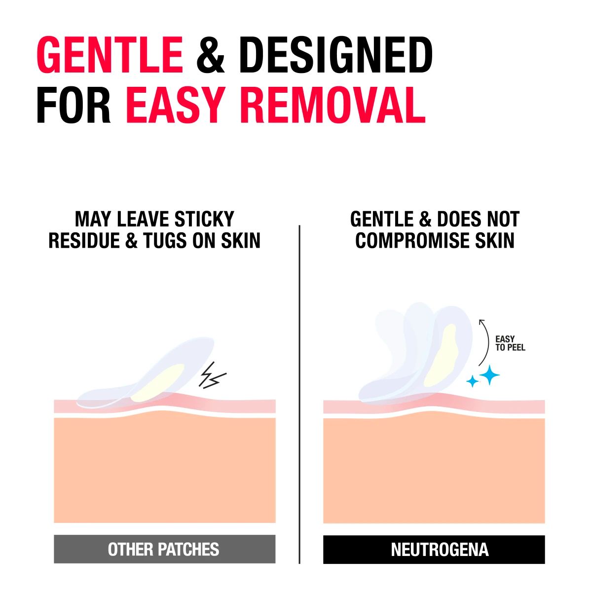 Neutrogena Sensitive Skin Blemish Patches 30 count — gentle removal