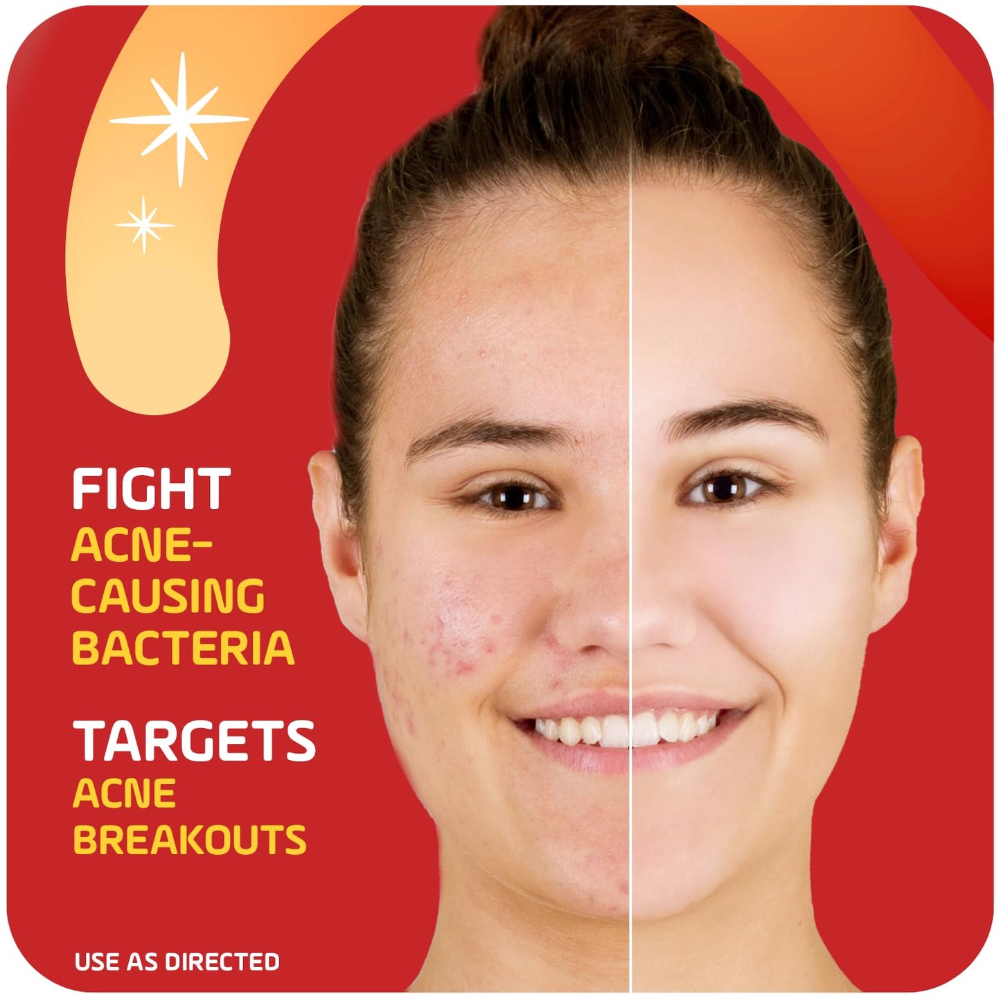 Asepxia 2% Salicylic Acid Acne Spot Treatment Cream | Drying Formula Targets Acne, Clears & Prevents Blemishes, Reduces Redness, Penetrates Pores, Pimple Cream, 1 Oz, 1-Pack, EXP 12/23