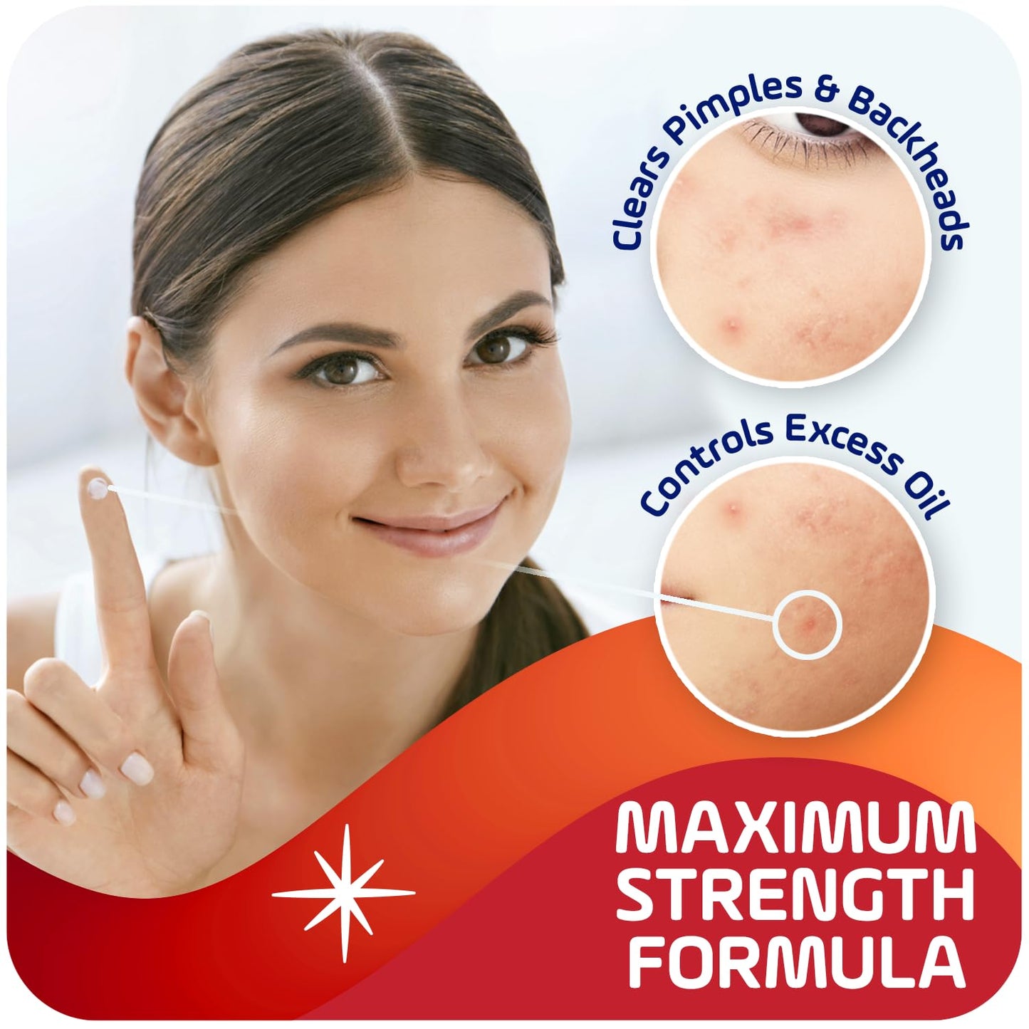 Asepxia 2% Salicylic Acid Acne Spot Treatment Cream | Drying Formula Targets Acne, Clears & Prevents Blemishes, Reduces Redness, Penetrates Pores, Pimple Cream, 1 Oz, 1-Pack, EXP 12/23