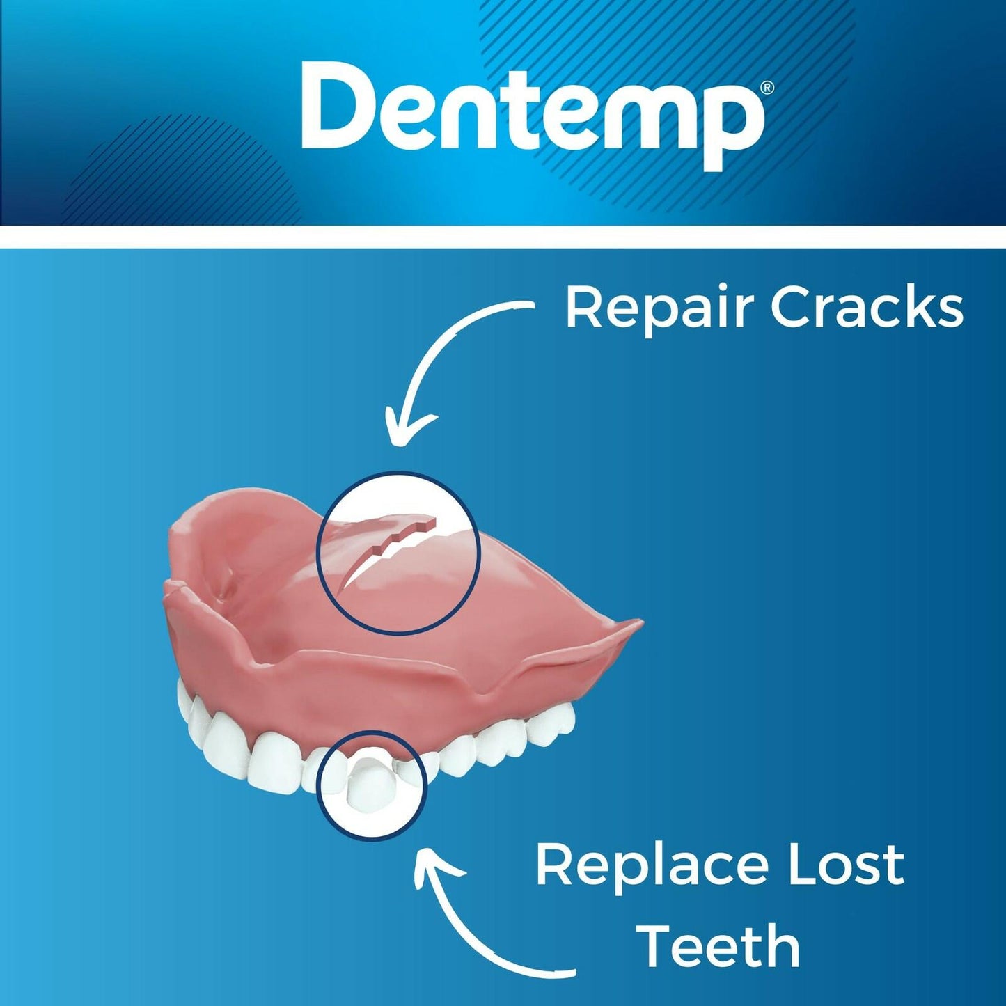 Dentemp Repair Kit - Repair-It Advanced Formula Denture Repair Kit - Denture Repair Kit Repairs Broken Dentures - Denture Repair to Mend Cracks & Replace Loose Teeth